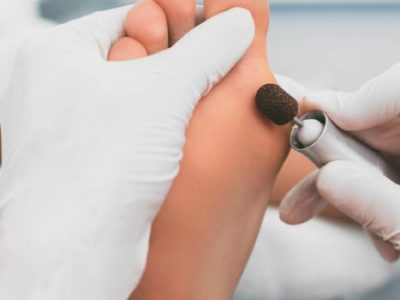 medizinische Fußpflege Fuß Handschuhe