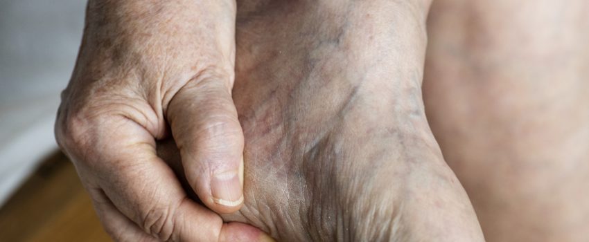 burning-feet-syndrom-brennende-fuesse-o20988bu79vrwktzrcvihtfo6hfu0a4jowgh17xlik