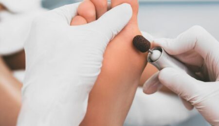 fusspflege-bei-polyneuropathie-o8j8yawmvbyytgv18suwno1lcgwga8ssrsvcloi88c medizinische Fußpflege Fuß Handschuhe