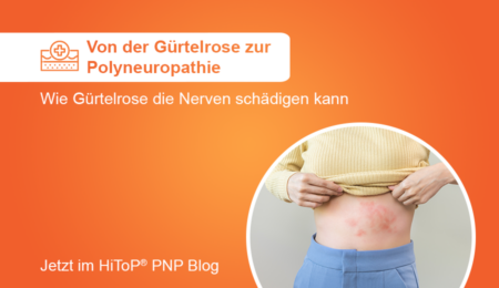 gbo_Blogbeitrag_Gürtelrose