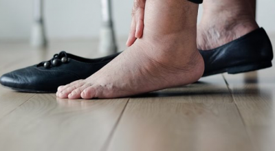 Unbenannt Diabetischer Fuß